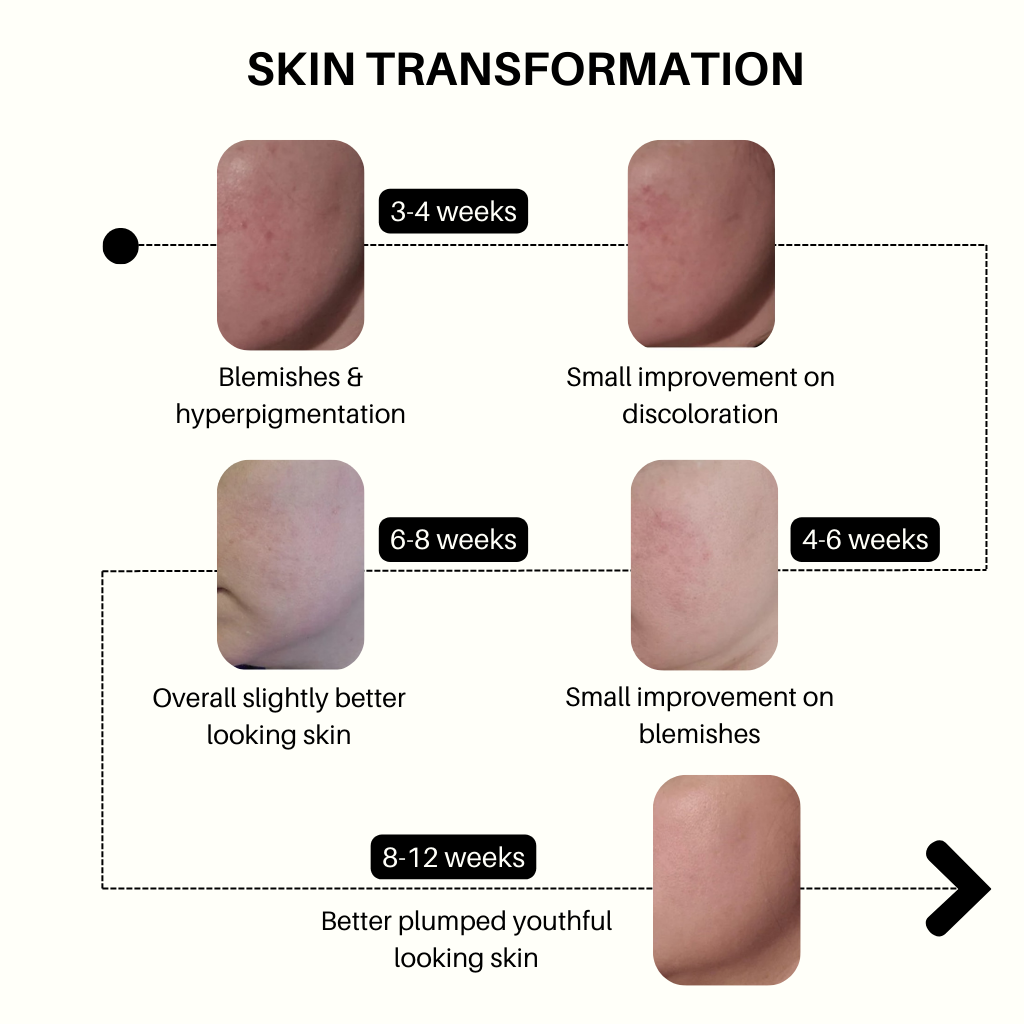 Multi Molecular Hyaluronic Retinal Serum
