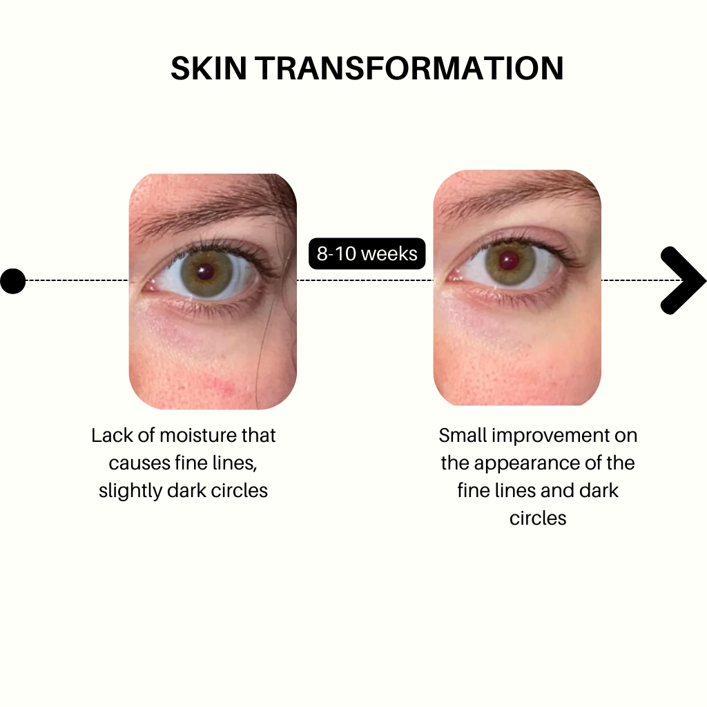 Multi Molecular Hyaluronic Peptide Eye Cream